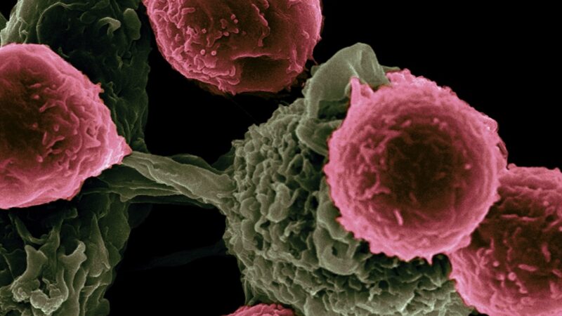 Cancer cells under microscope