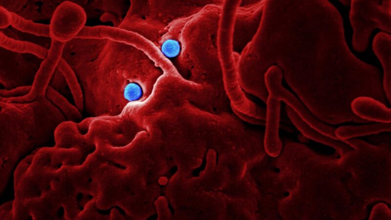 Virus under microscope