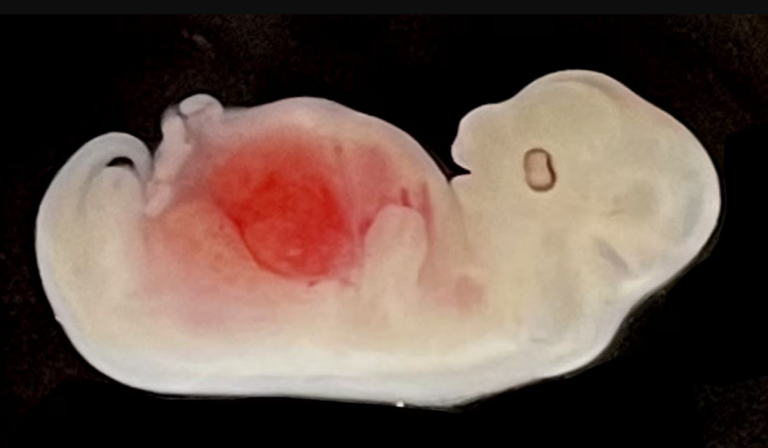 Pig embryo with human kidney